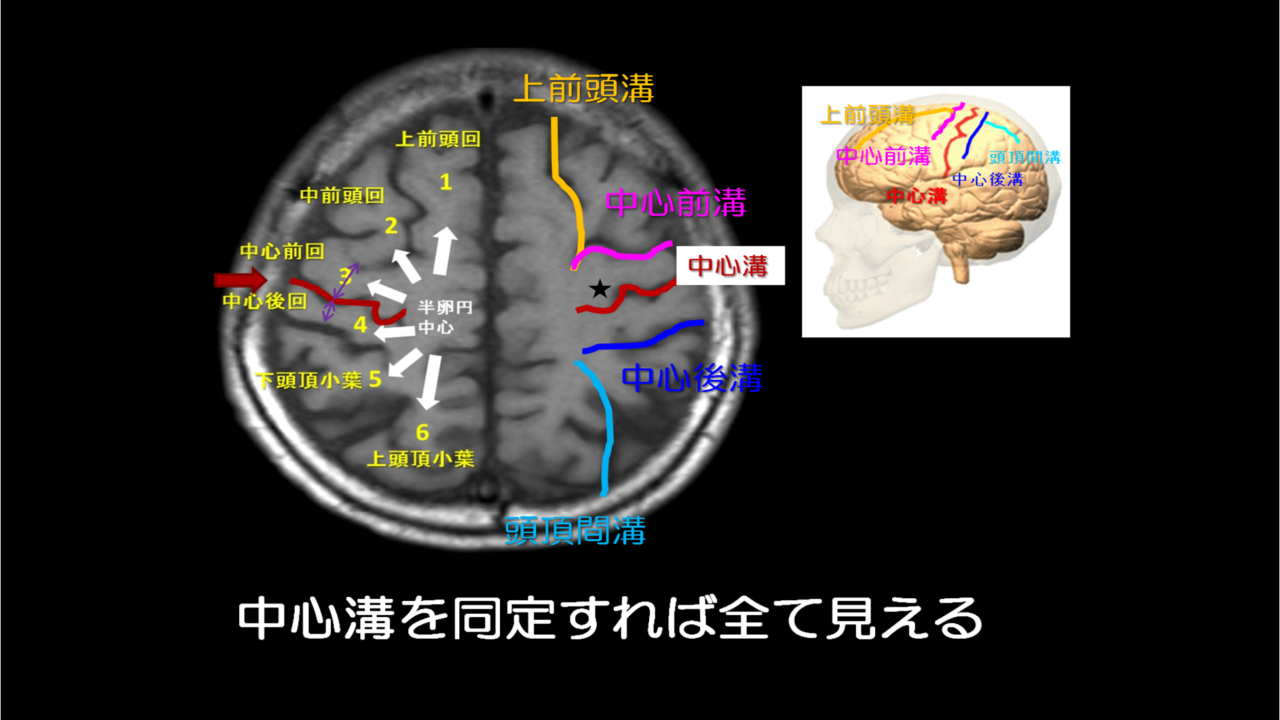 脳の機能解剖と画像診断