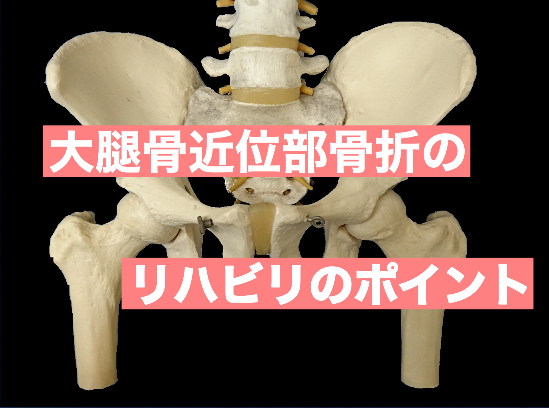 大腿骨近位部骨折のリハビリのポイント ～基礎の基礎から落とし込む